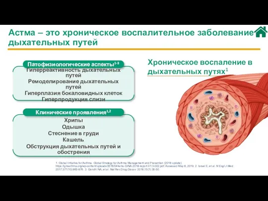 Хроническое воспаление в дыхательных путях1 1. Global Initiative for Asthma. Global