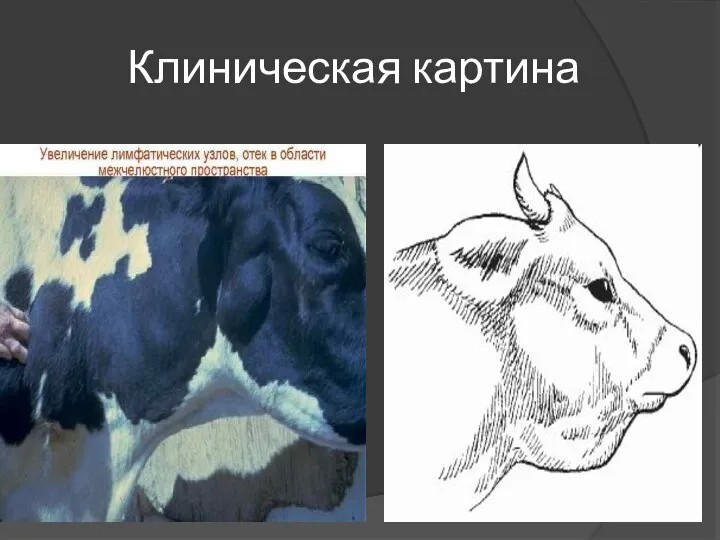 Клиническая картина