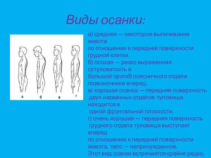 Виды осанки: а) средняя — некоторое выпячивание живота по отношению к