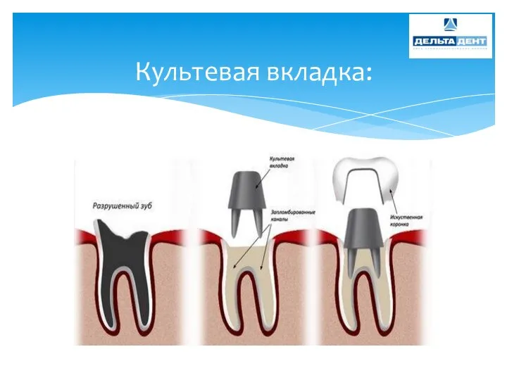 Культевая вкладка: