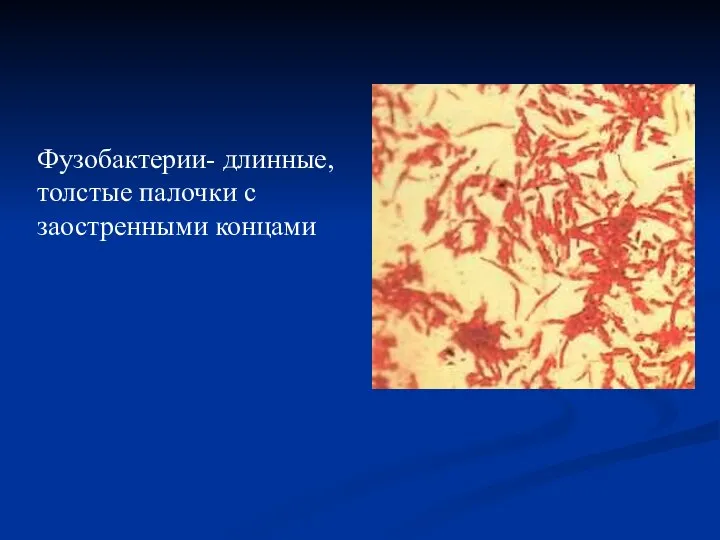 Фузобактерии- длинные, толстые палочки с заостренными концами