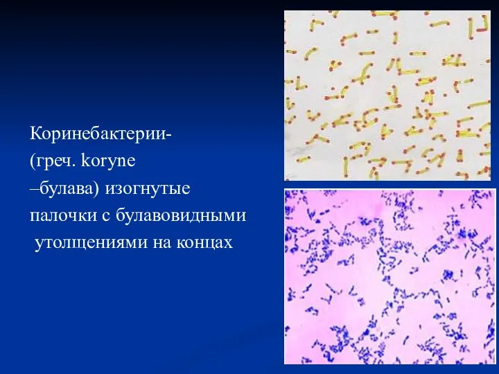 Коринебактерии- (греч. koryne –булава) изогнутые палочки с булавовидными утолщениями на концах