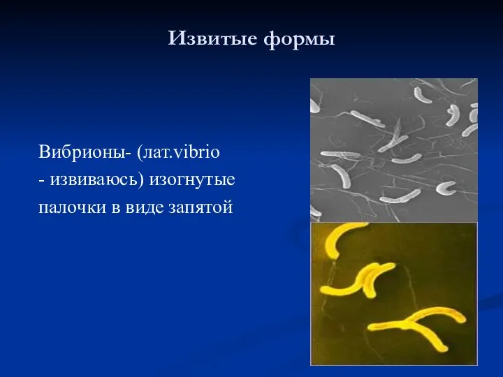 Извитые формы Вибрионы- (лат.vibrio - извиваюсь) изогнутые палочки в виде запятой