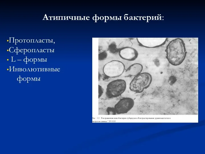 Атипичные формы бактерий: Протопласты, Сферопласты L – формы Инволютивные формы