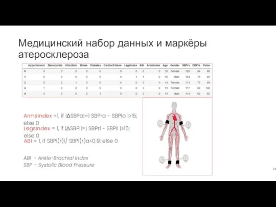 Медицинский набор данных и маркёры атеросклероза ArmsIndex =1, if |ΔSBPa|=| SBPra