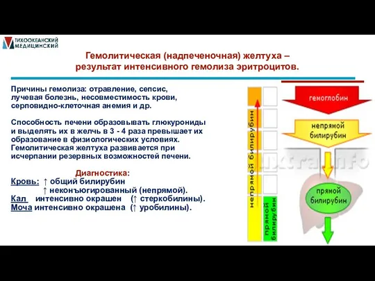 Гемолитическая (надпеченочная) желтуха – результат интенсивного гемолиза эритроцитов. Причины гемолиза: отравление,