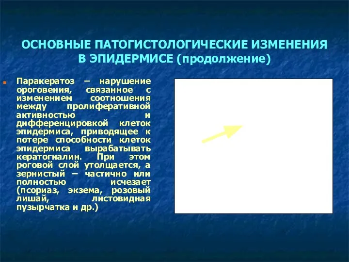 ОСНОВНЫЕ ПАТОГИСТОЛОГИЧЕСКИЕ ИЗМЕНЕНИЯ В ЭПИДЕРМИСЕ (продолжение) Паракератоз – нарушение ороговения, связанное