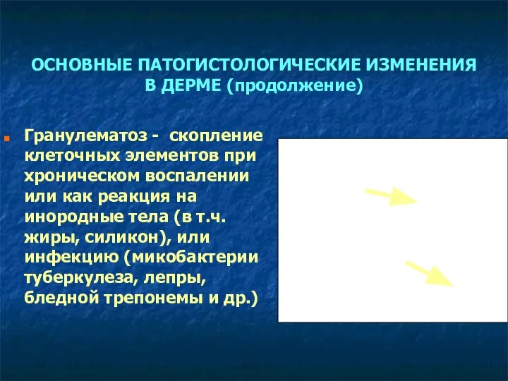 ОСНОВНЫЕ ПАТОГИСТОЛОГИЧЕСКИЕ ИЗМЕНЕНИЯ В ДЕРМЕ (продолжение) Гранулематоз - скопление клеточных элементов