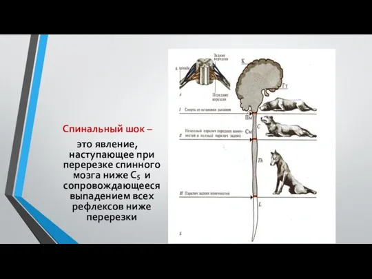 Спинальный шок – это явление, наступающее при перерезке спинного мозга ниже