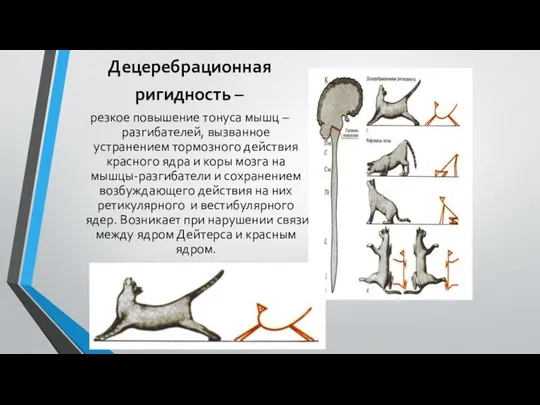 Децеребрационная ригидность – резкое повышение тонуса мышц – разгибателей, вызванное устранением