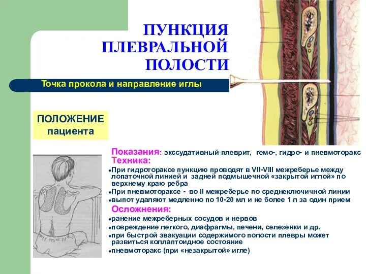 ПУНКЦИЯ ПЛЕВРАЛЬНОЙ ПОЛОСТИ Показания: экссудативный плеврит, гемо-, гидро- и пневмоторакс Техника: