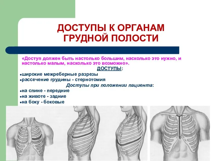 ДОСТУПЫ К ОРГАНАМ ГРУДНОЙ ПОЛОСТИ «Доступ должен быть настолько большим, насколько