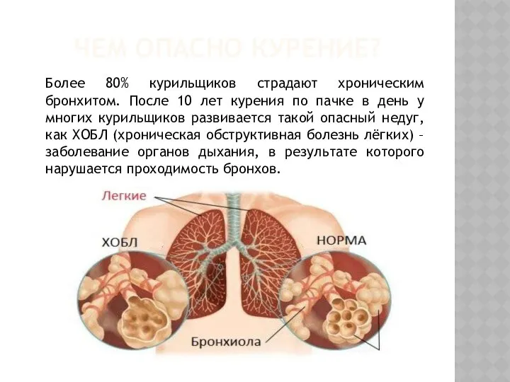 ЧЕМ ОПАСНО КУРЕНИЕ? Более 80% курильщиков страдают хроническим бронхитом. После 10