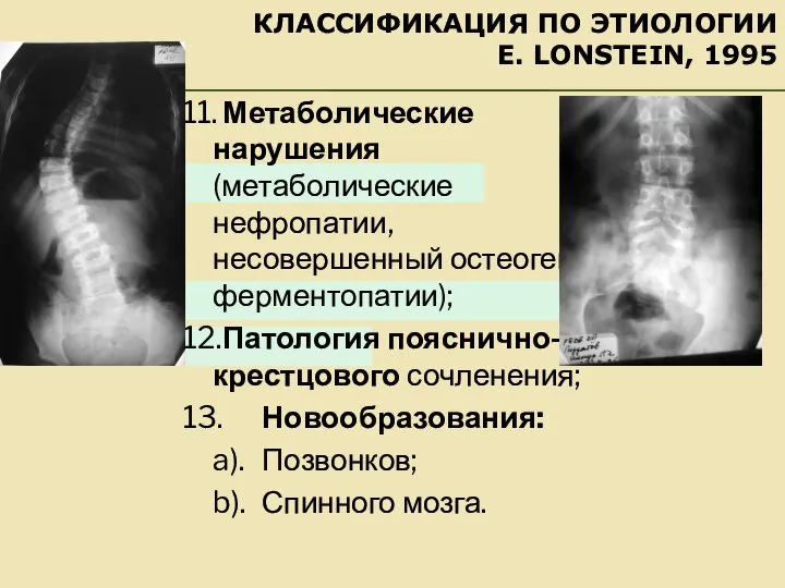 КЛАССИФИКАЦИЯ ПО ЭТИОЛОГИИ E. LONSTEIN, 1995 11. Метаболические нарушения (метаболические нефропатии,