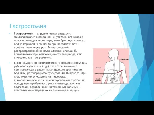 Гастростомия Гастростоми́я — хирургическая операция, заключающаяся в создании искусственного входа в