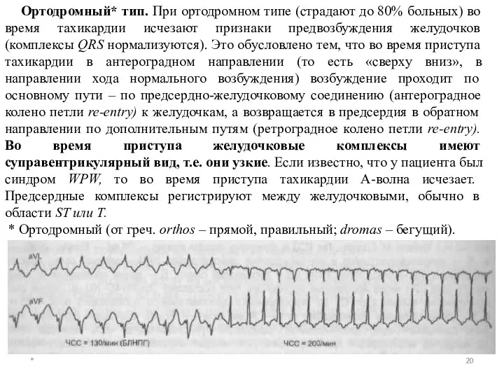 * Ортодромный* тип. При ортодромном типе (страдают до 80% больных) во