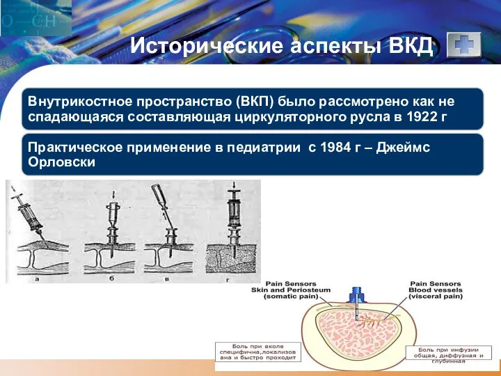 Исторические аспекты ВКД