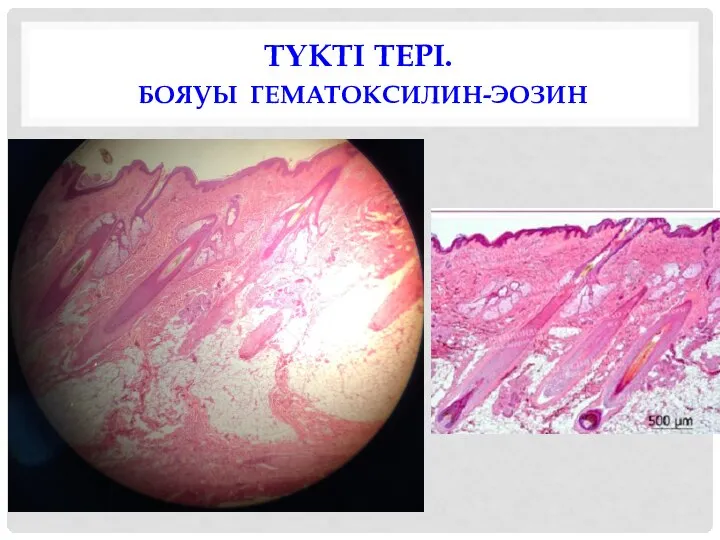 ТҮКТІ ТЕРІ. БОЯУЫ ГЕМАТОКСИЛИН-ЭОЗИН