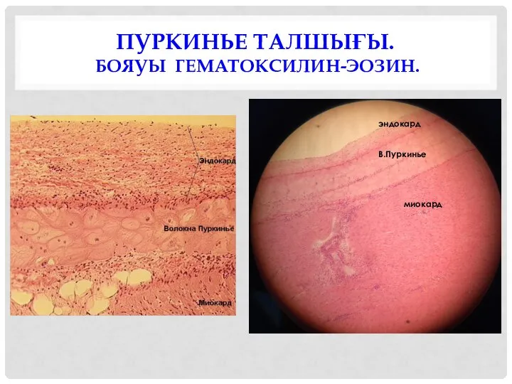 ПУРКИНЬЕ ТАЛШЫҒЫ. БОЯУЫ ГЕМАТОКСИЛИН-ЭОЗИН. эндокард В.Пуркинье миокард