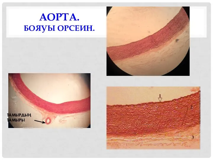 АОРТА. БОЯУЫ ОРСЕИН. ТАМЫРДЫҢ ТАМЫРЫ