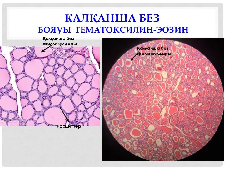 ҚАЛҚАНША БЕЗ БОЯУЫ ГЕМАТОКСИЛИН-ЭОЗИН Тироциттер Қалқанша без фолликулдары Қалқанша без фолликулдары