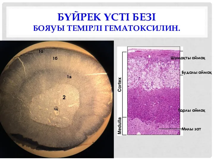 БҮЙРЕК ҮСТІ БЕЗІ БОЯУЫ ТЕМІРЛІ ГЕМАТОКСИЛИН. 2 1а 1б 1в Милы