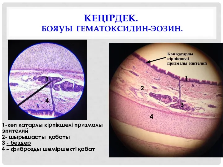 КЕҢІРДЕК. БОЯУЫ ГЕМАТОКСИЛИН-ЭОЗИН. 1-көп қатарлы кірпікшелі призмалы эпителий 2- шырышасты қабаты