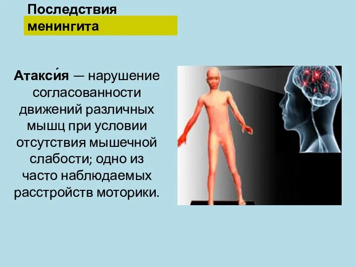 Последствия менингита Атакси́я — нарушение согласованности движений различных мышц при условии