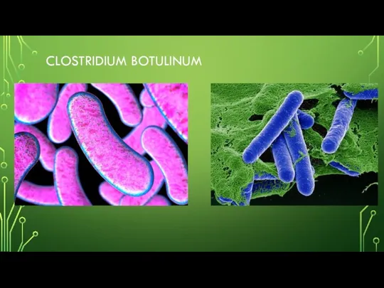 CLOSTRIDIUM BOTULINUM