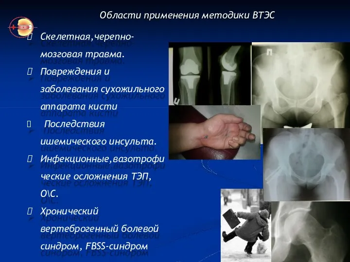 Области применения методики ВТЭС Скелетная,черепно- мозговая травма. Повреждения и заболевания сухожильного