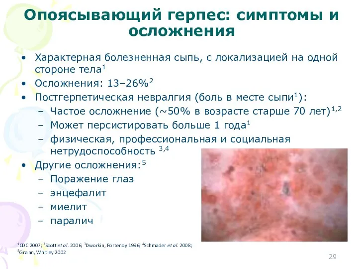 Опоясывающий герпес: симптомы и осложнения Характерная болезненная сыпь, с локализацией на