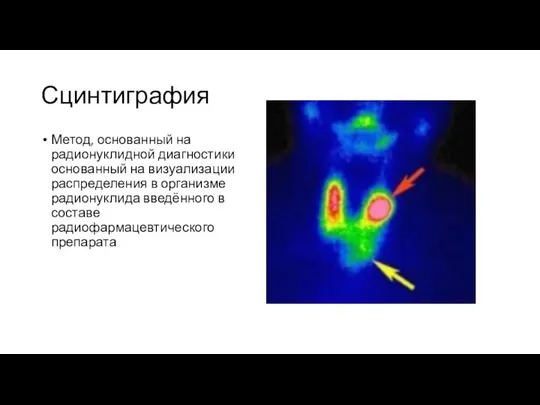 Сцинтиграфия Метод, основанный на радионуклидной диагностики основанный на визуализации распределения в