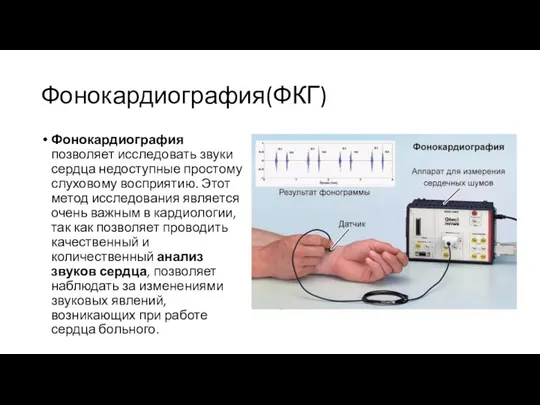 Фонокардиография(ФКГ) Фонокардиография позволяет исследовать звуки сердца недоступные простому слуховому восприятию. Этот