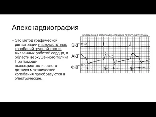 Апекскардиография Это метод графической регистрации низкочастотных колебаний грудной клетки, вызванных работой