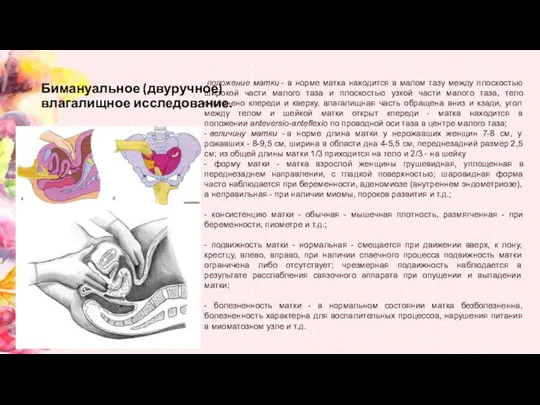 Бимануальное (двуручное) влагалищное исследование. положение матки - в норме матка находится