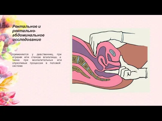 Ректальное и ректально-абдоминальное исследование приме­няется у девственниц, при атрезии или стенозе
