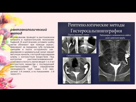 рентгенологический метод Исследование проводят в рентгеновском кабинете в горизонтальном положении больной.