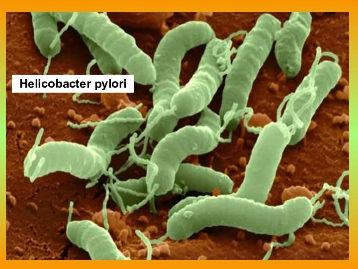 Helicobacter pylori