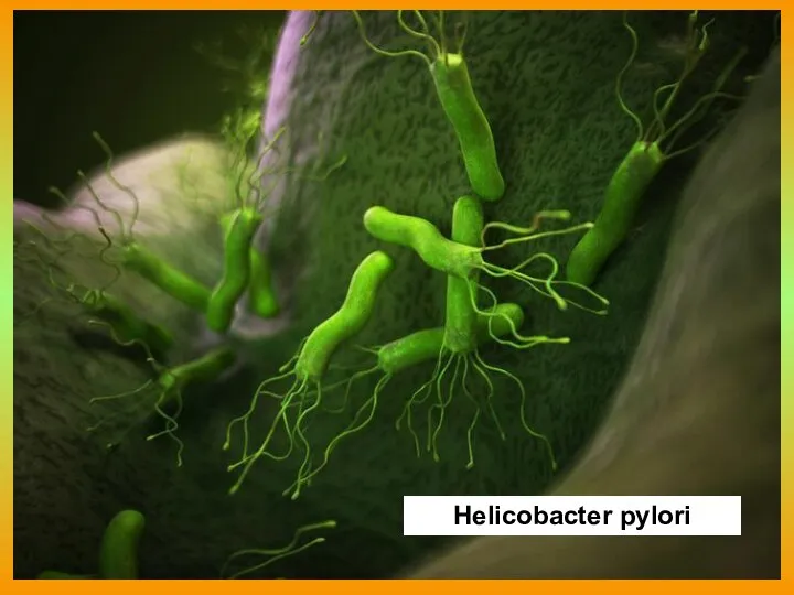 Helicobacter pylori