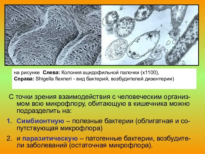 на рисунке Слева: Колония ацидофильной палочки (х1100), Справа: Shigella flexneri -