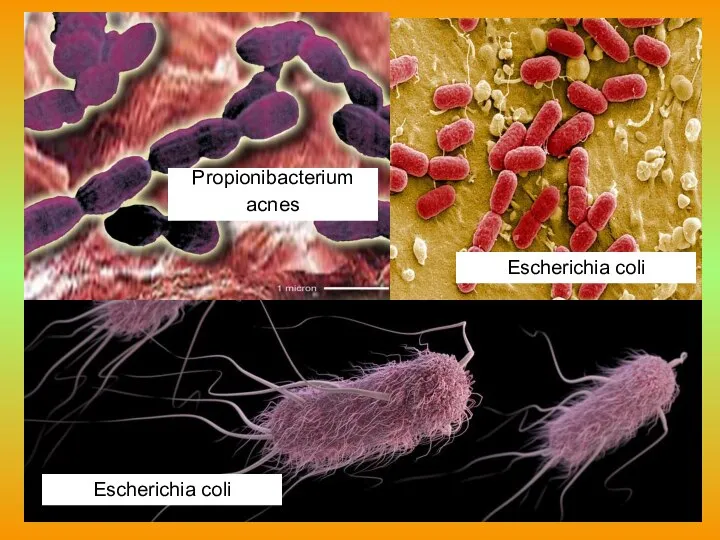 Propionibacterium acnes Escherichia coli Escherichia coli