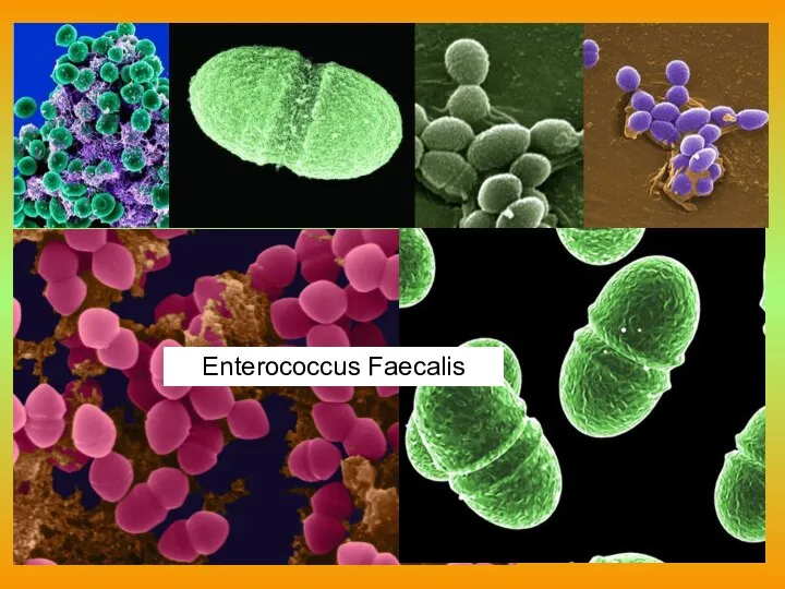 Enterococcus Faecalis