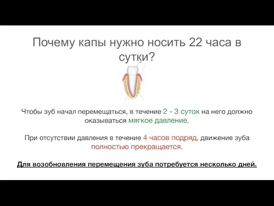 Почему капы нужно носить 22 часа в сутки? Чтобы зуб начал