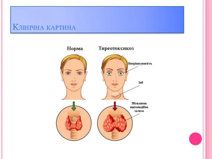 Клінічна картина