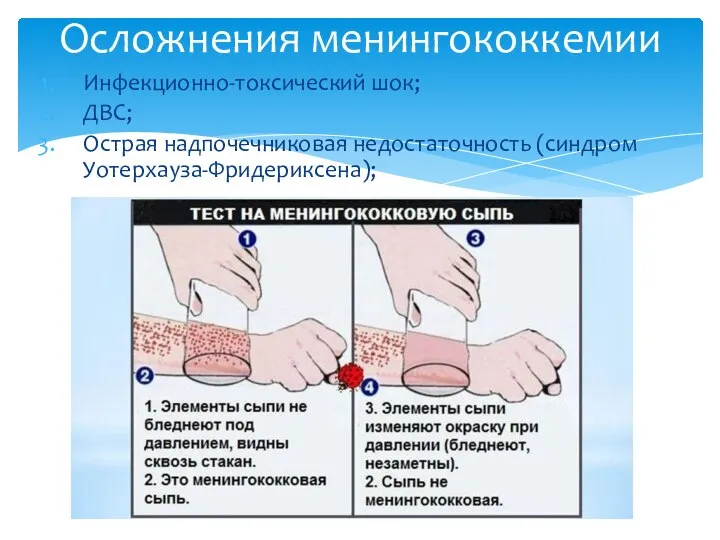 Инфекционно-токсический шок; ДВС; Острая надпочечниковая недостаточность (синдром Уотерхауза-Фридериксена); Осложнения менингококкемии