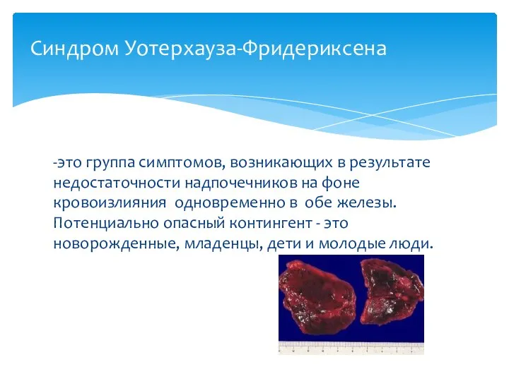 -это группа симптомов, возникающих в результате недостаточности надпочечников на фоне кровоизлияния