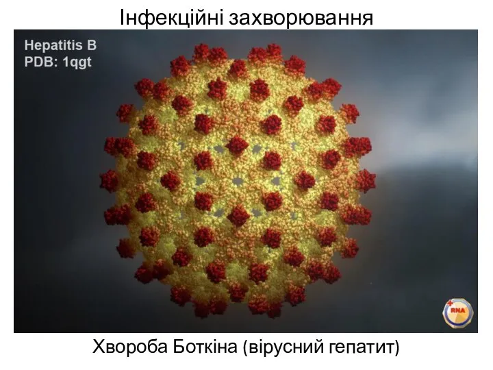 Інфекційні захворювання Хвороба Боткіна (вірусний гепатит)