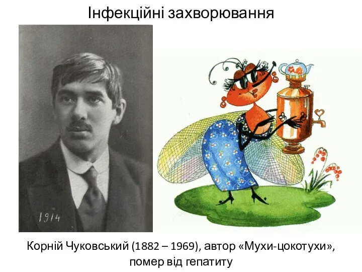 Інфекційні захворювання Корній Чуковський (1882 – 1969), автор «Мухи-цокотухи», помер від гепатиту