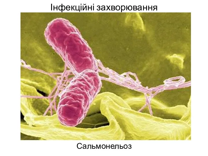 Інфекційні захворювання Сальмонельоз