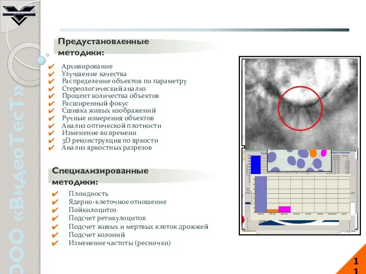 ООО «ВидеоТесТ» 11 Архивирование Улучшение качества Распределение объектов по параметру Стереологический
